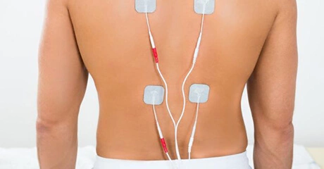 Back with Spinal Cord Stimulation